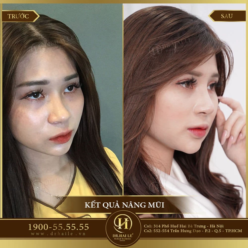 Dịch vụ cao cấp