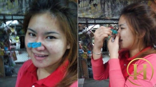 Jenny thường xuyên sử dụng kẹp quần áo với hi vọng sẽ giúp mũi cao hơn