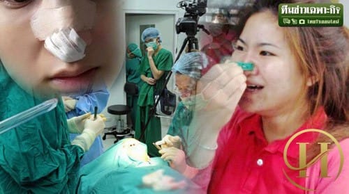 Các bác sĩ khẳng định phương pháp này hoàn toàn không có hiệu quả và có thể khiến mũi bị tổn thương