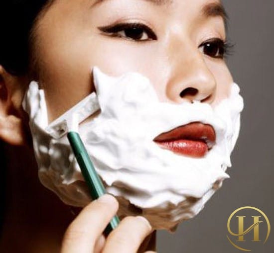 Hình ảnh triệt lông mép ở phụ nữ