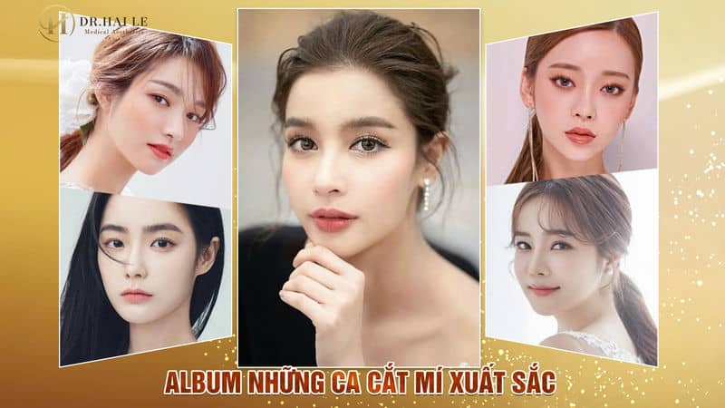 [ALBUM] TỔNG HỢP 1001 NHỮNG CA THẨM MỸ MẮT ĐẸP XUẤT SẮC NĂM 2021