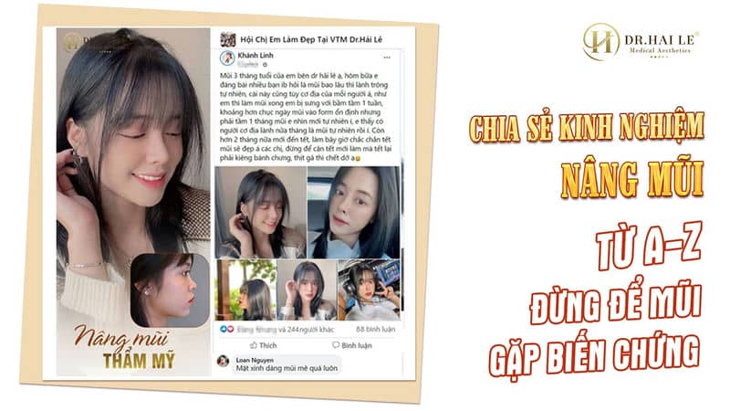Chia sẻ kinh nghiệm nâng mũi từ A - Z tại Dr.Hải Lê!