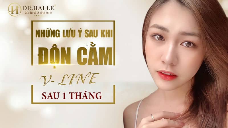 Những lưu ý sau khi độn cằm V-Line sau 1 tháng!