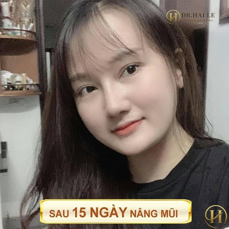 sau 15 ngày