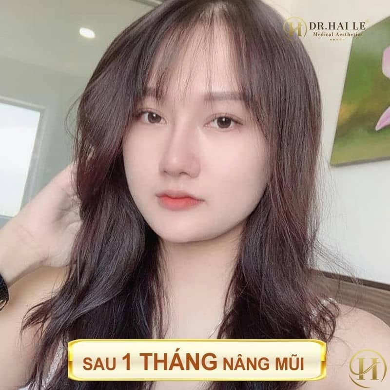 Mũi sau 1 tháng