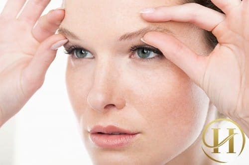 Các triệu chứng gây sụp mí mắt