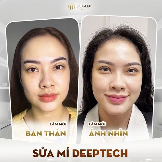 sua-mi-khong-deu
