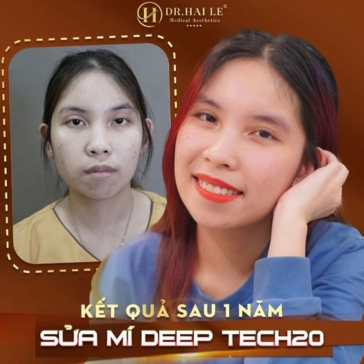sua-mi-khong-deu
