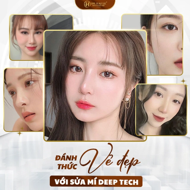 sua-mi-deep-tech-tai-drhai-le-tai-sinh-ve-dep-cho-cua-so-tam-hon