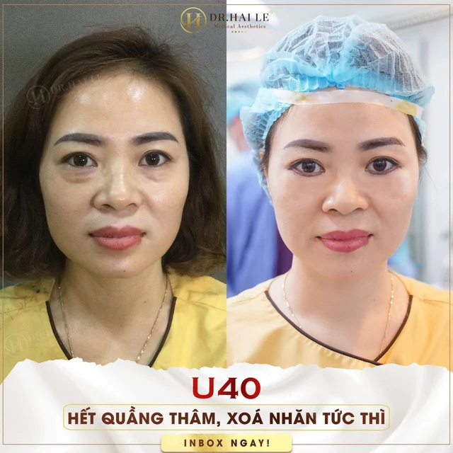 cach-khac-phuc-cat-mi-duoi-bi-hong-an-toan