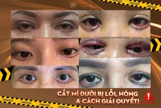 cach-khac-phuc-cat-mi-duoi-bi-hong-an-toan