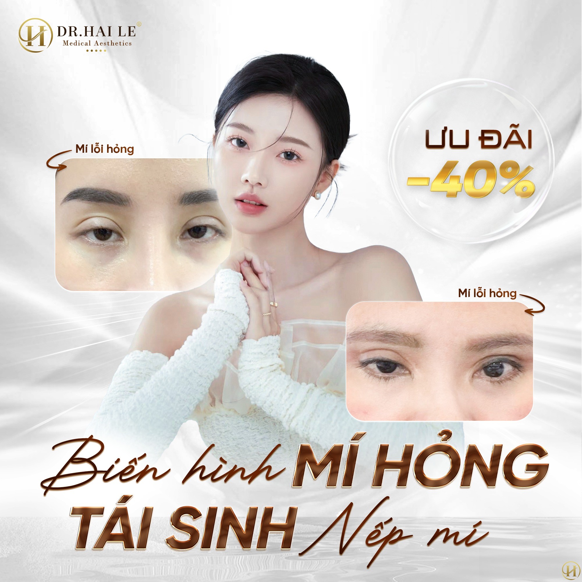 cat-mi-bi-loi-va-nhung-he-luy-di-kem