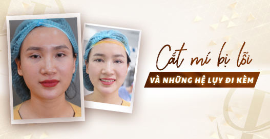 Cắt mí bị lỗi và những hệ lụy đi kèm?