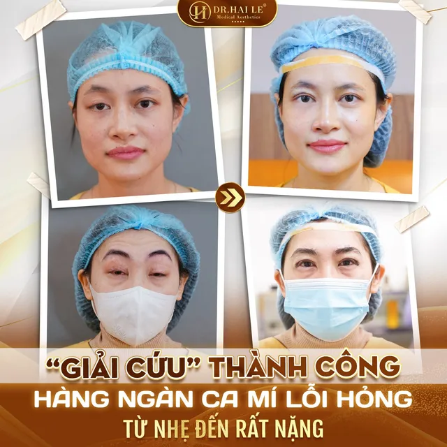 cat-mi-mat-qua-to-phai-lam-the-nao