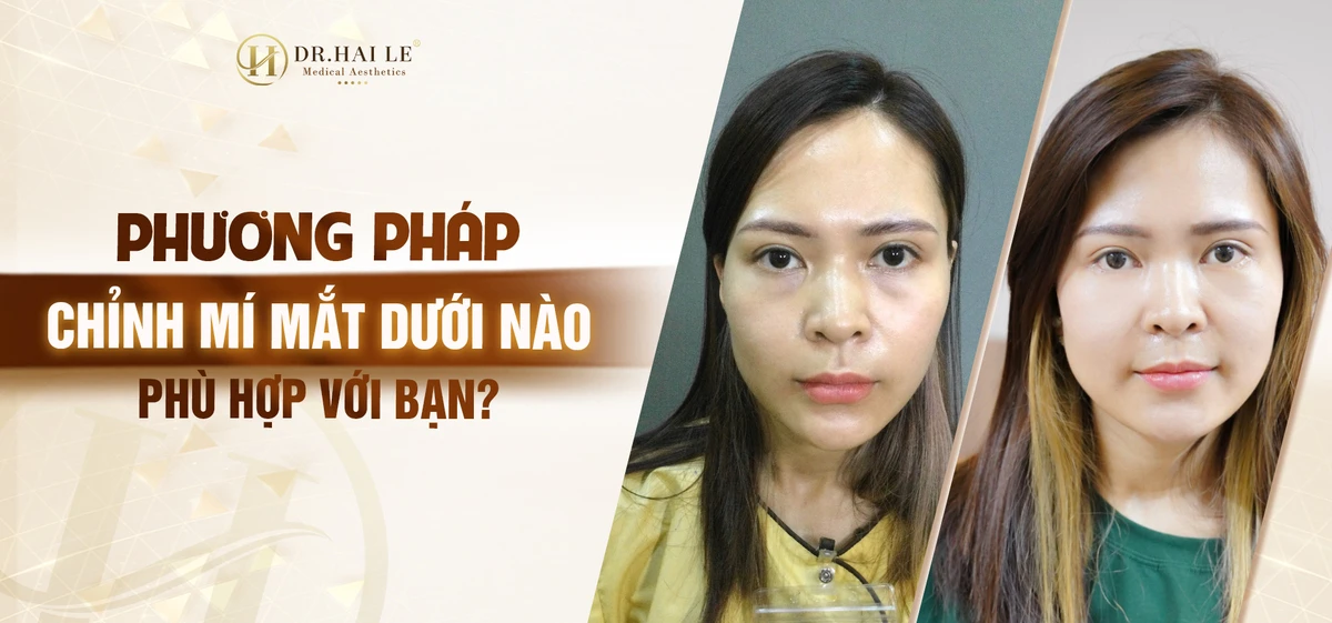 chinh-mi-duoi