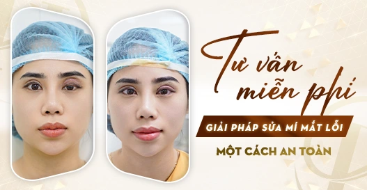 Dr.Hải Lê - Tư vấn miễn phí giải pháp sửa mí mắt lỗi?