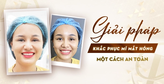 Giải pháp khắc phục mí mắt hỏng an toàn? Giải pháp khắc phục mí mắt hỏng an toàn?