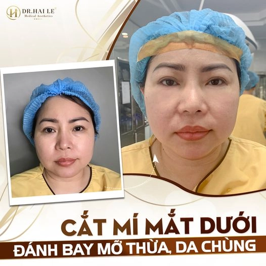 cat-mi-duoi