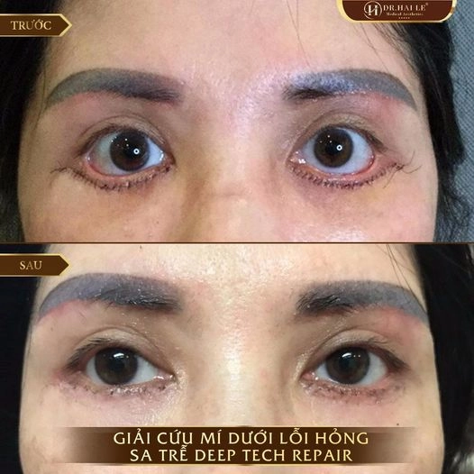 sua-mi-duoi