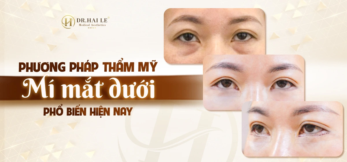 tham-my-mat-duoi