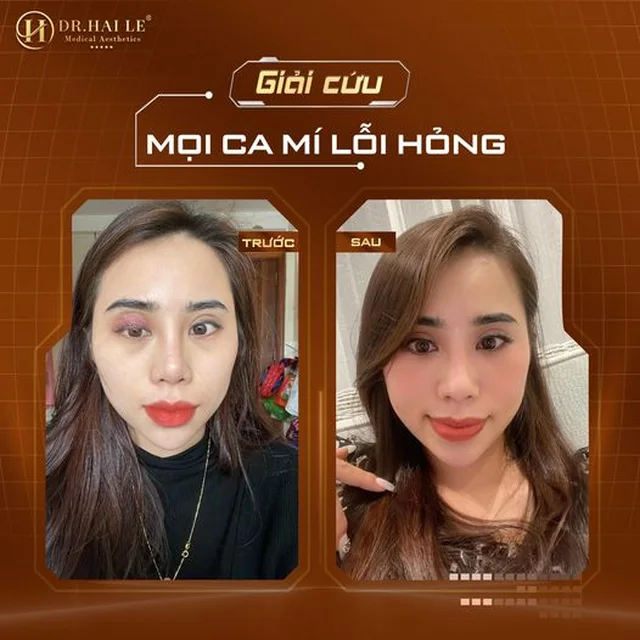 cat-mi-mat-khong-deu