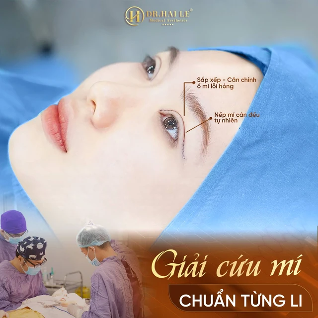 mi-mat-ben-to-ben-nho-co-khac-phuc-duoc-khong