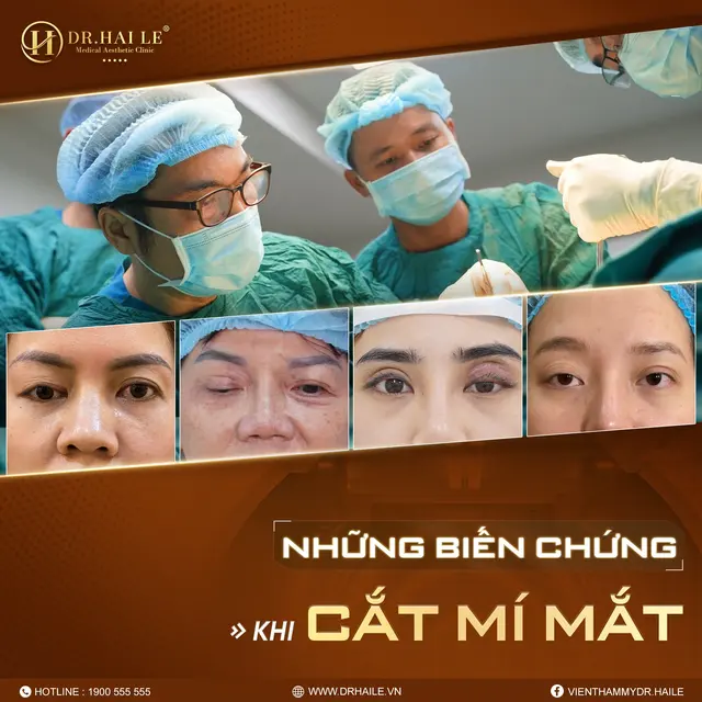 nang-tam-nhan-sac-sau-sua-loi-cat-mi-mat