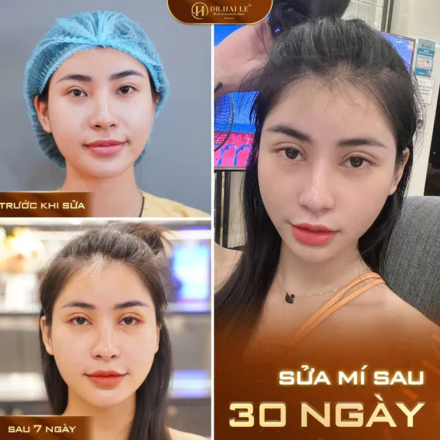 nang-tam-nhan-sac-sau-sua-loi-cat-mi-mat