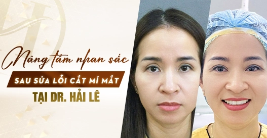 Nâng tầm nhan sắc sau sửa lỗi cắt mí mắt? Nâng tầm nhan sắc sau sửa lỗi cắt mí mắt?