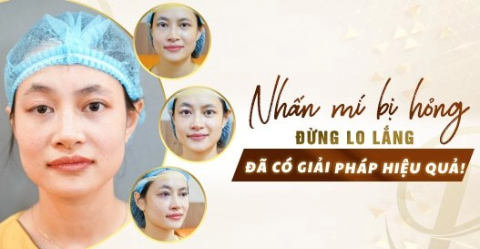 Nhấn mí bị hỏng - Đừng lo lắng, đã có giải pháp hiệu quả?