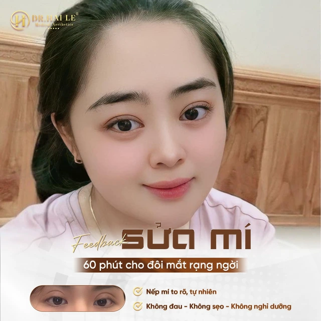 nhung-luu-y-quan-trong-giup-tranh-xa-nguy-co-cat-mi-hong