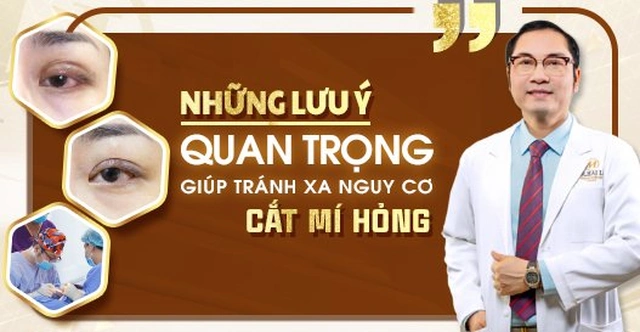 Những lưu ý quan trọng giúp tránh xa nguy cơ cắt mí hỏng?
