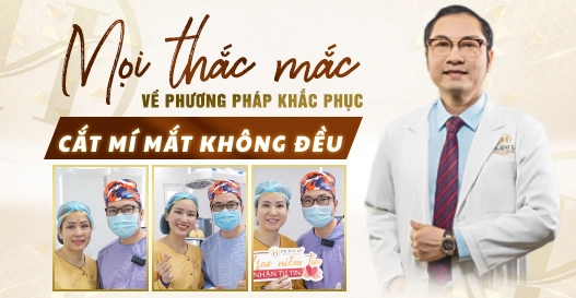 Hỏi đáp: Mọi thắc mắc về phương pháp khắc phục cắt mí mắt không đều Hỏi đáp: Mọi thắc mắc về phương pháp khắc phục cắt mí mắt không đều