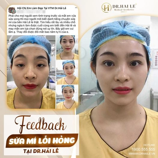 sua-mi-hong