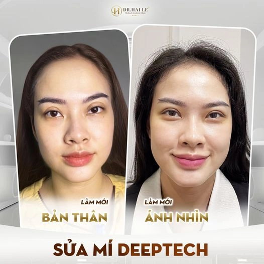 sua-mi-deeptech