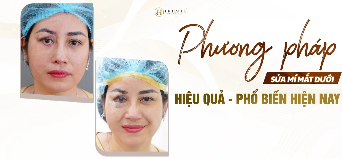 phuong-phap-sua-mi-mat-duoi-hieu-qua