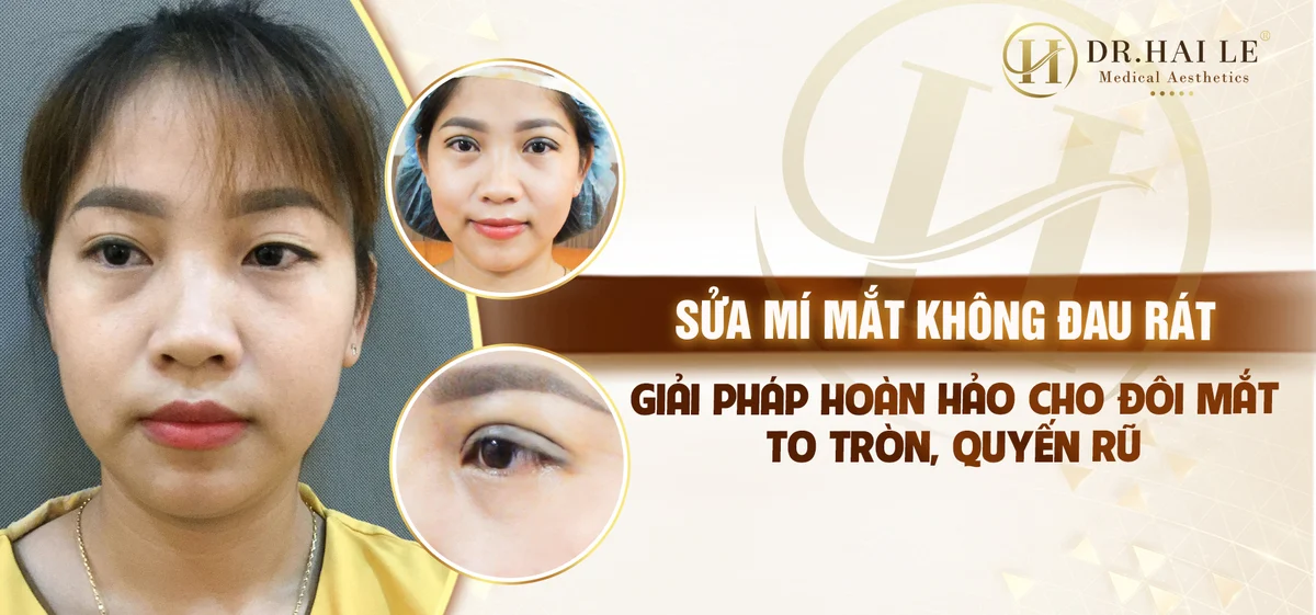 sua-mi-mat-khong-dau-rat