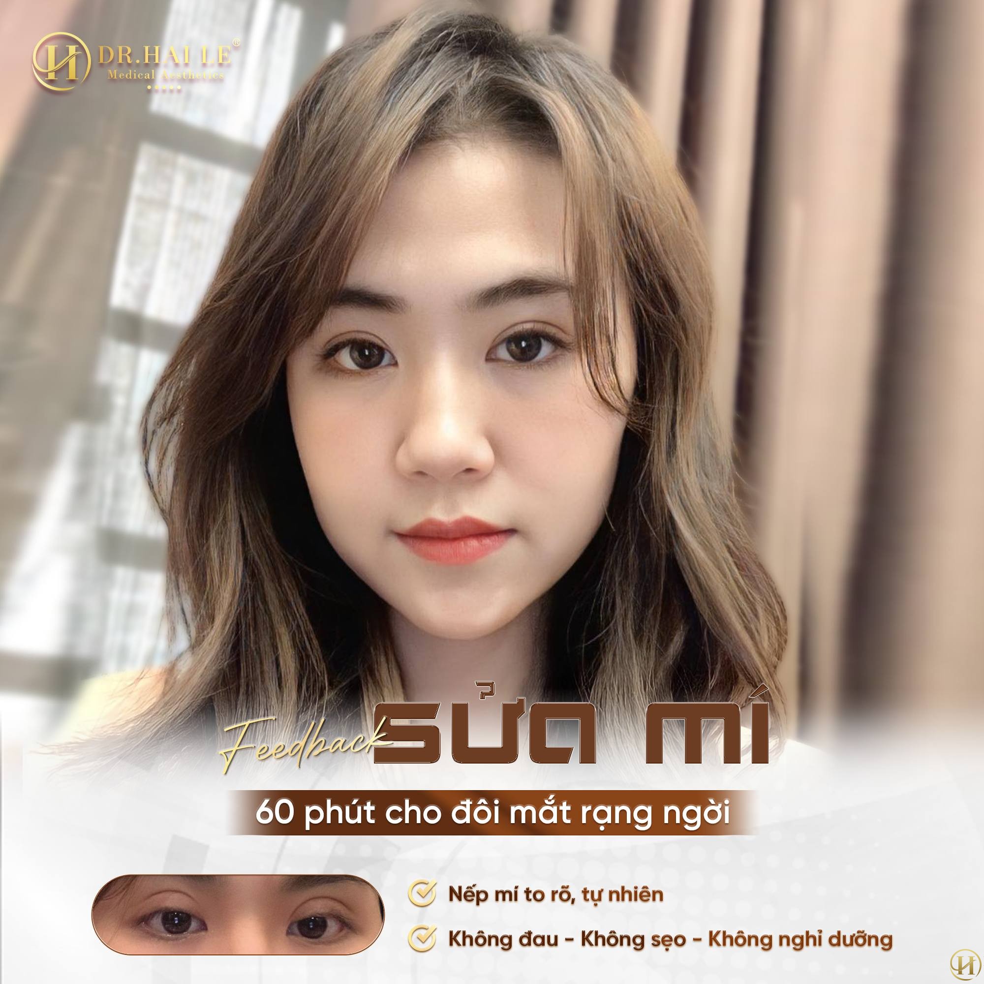 sua-cat-mi-loi-bi-quyet-tai-sinh-ve-dep-tu-nhien