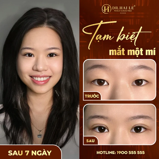 sua-mat-1-mi-thanh-2-mi-hieu-qua-lau-dai-tai-drhai-le