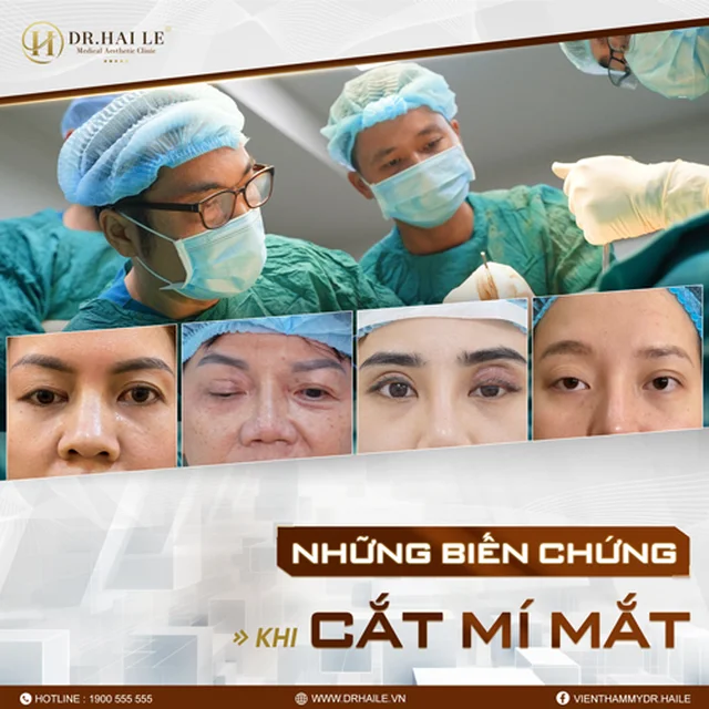 sua-mi-mat-hong-hieu-qua-tai-drhai-le