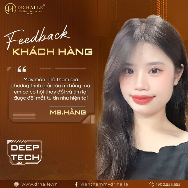 thay-doi-dien-mao-nhanh-chong-giai-phap-cho-mi-mat-loi