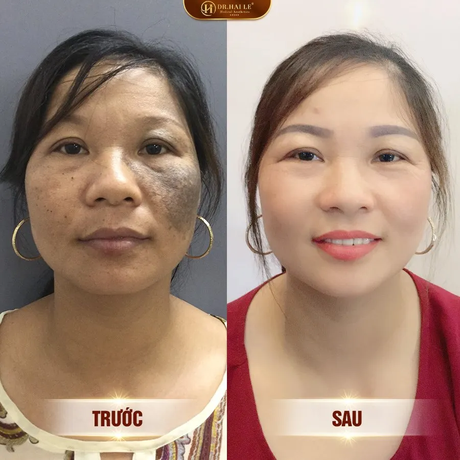 Quy-tu-thien-doi-ban-tay