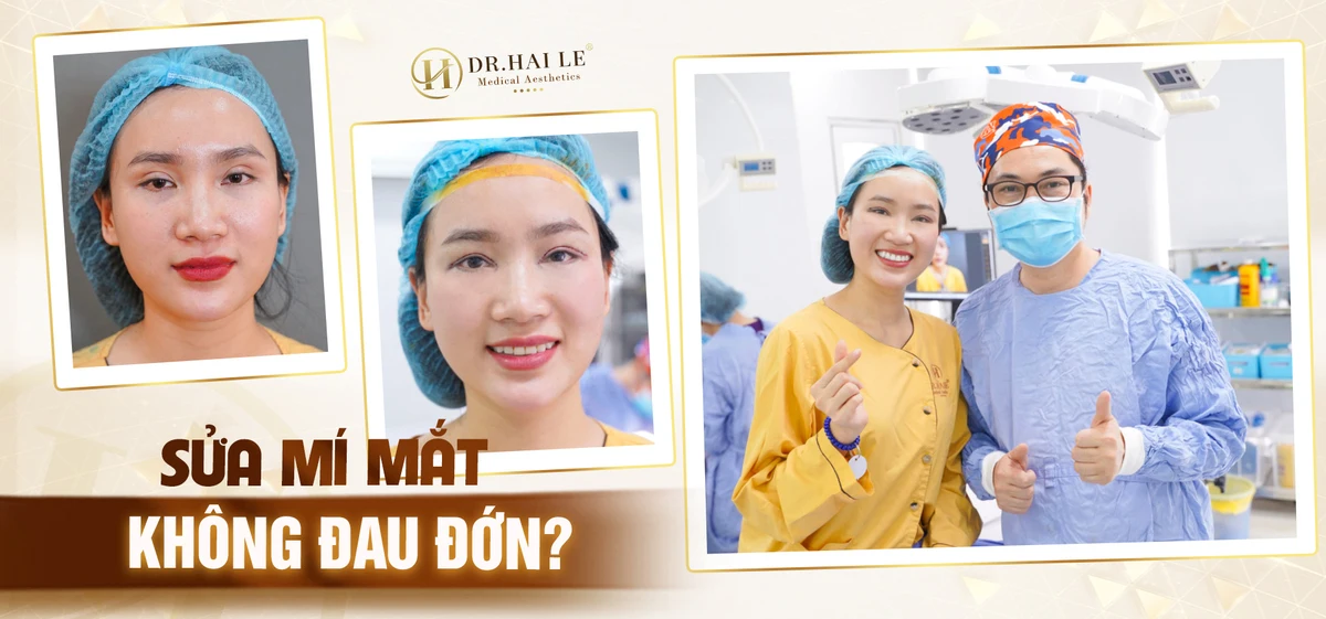 Sửa mí mắt không đau đớn?
