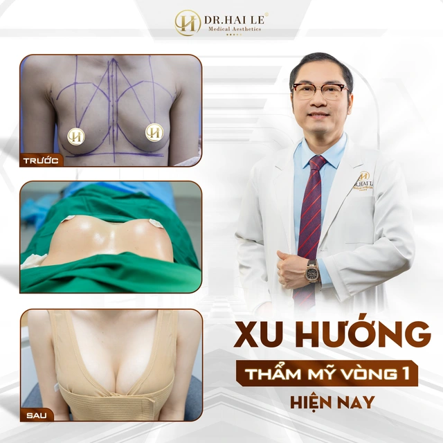 Xu-huong-vong-1-hien-nay