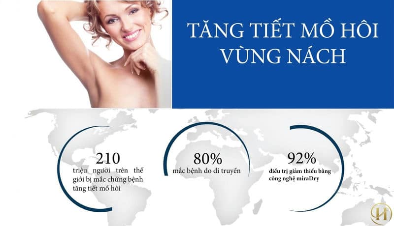 trị hôi nách bằng công nghệ miradry