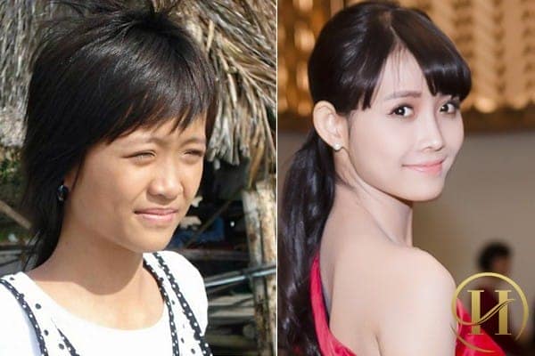 Trương Mỹ Nhân thừa nhận đã thẩm mỹ thu gọn đầu mũi