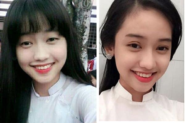 Lộ bằng chứng tình địch của Midu đã nâng mũi cắt mí mắt