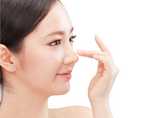 Có nên nâng mũi Demi-5D không?