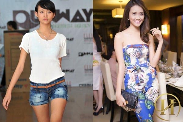 Hình ảnh hồi năm 2012 so với hình ảnh hiện tại có thể thấy làn da của Mỹ Nhân đã được thay mới hoàn toàn. 