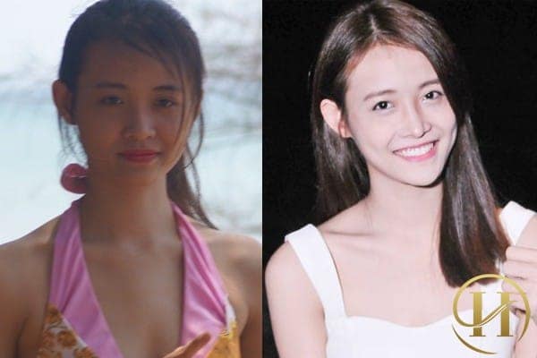 Trương Mỹ Nhân xinh đẹp nhờ độn cằm V-Line